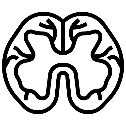 Beyincik Sarkması (Arnold Chiari)